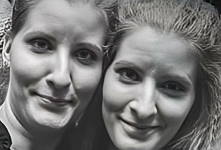 huszti hungarian twins scotland death phone